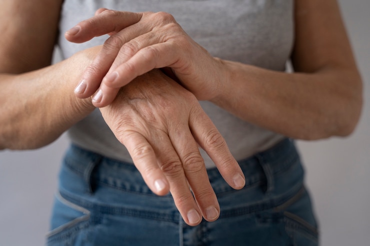 Como tratar a artrite