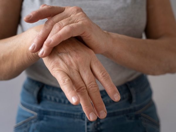 Como tratar a artrite